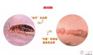 隐翅虫会主动咬人吗 隐翅虫咬人后图片